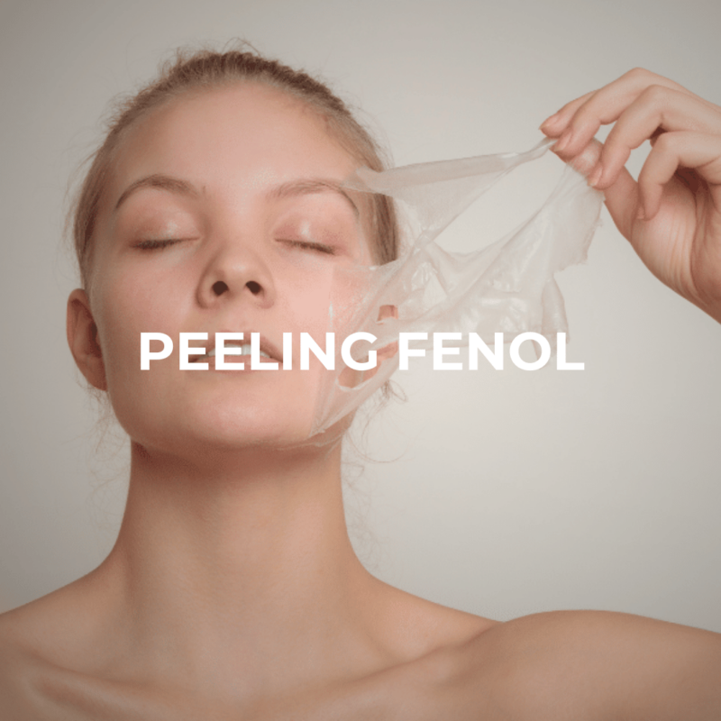 Peeling de Fenol