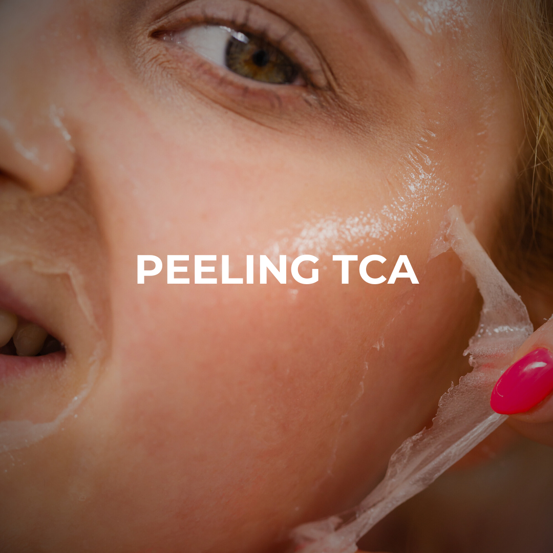 Peeling TCA Peeling TCA